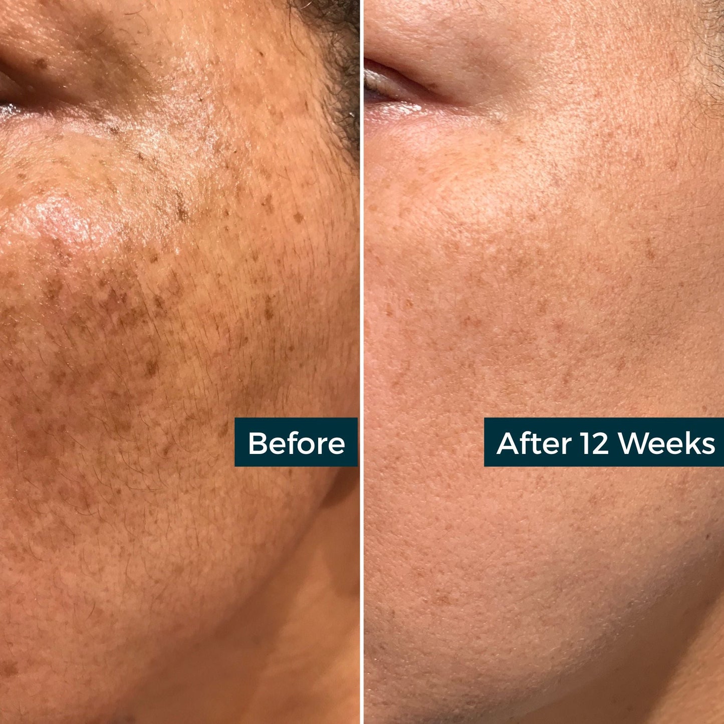 DETOX FACE OIL