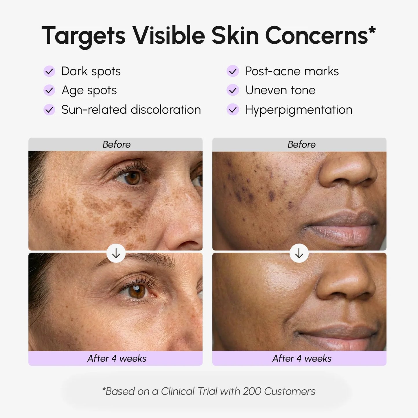 Face & Body Serum Corrector for Dark Spots