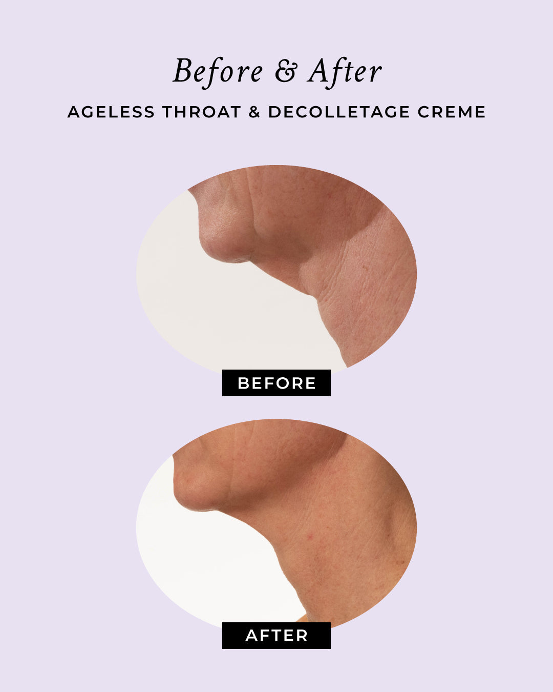 Lift and Firm Decolletage Proteins for Neck and Face