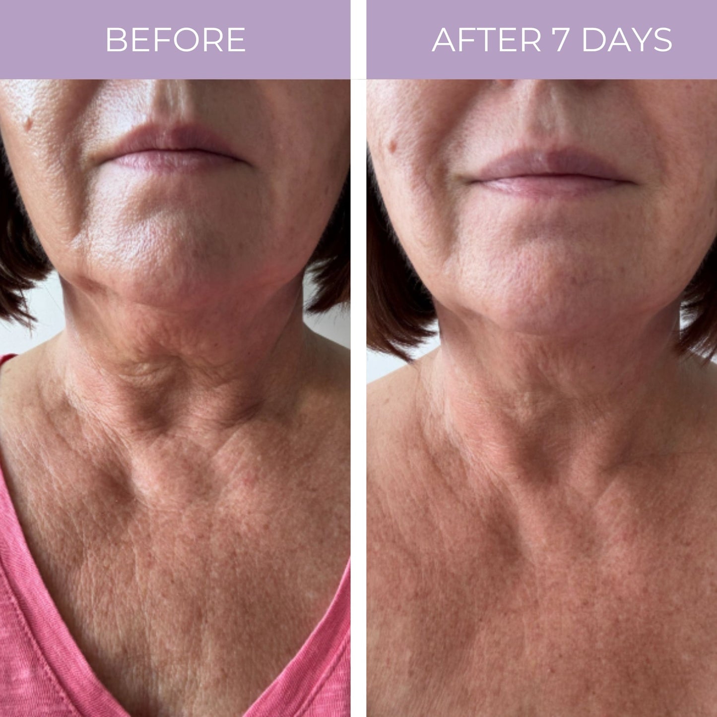Lift and Firm Decolletage Proteins for Neck and Face